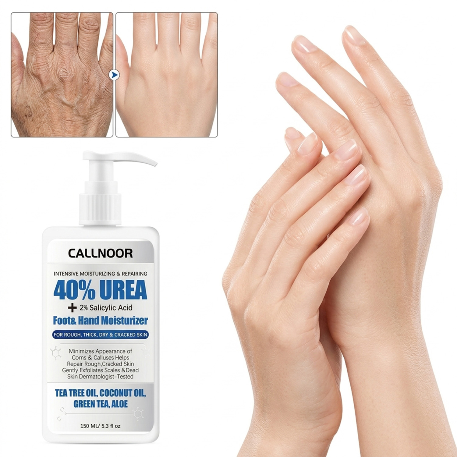 Urea Foot Cream - Krem do rąk i stóp z