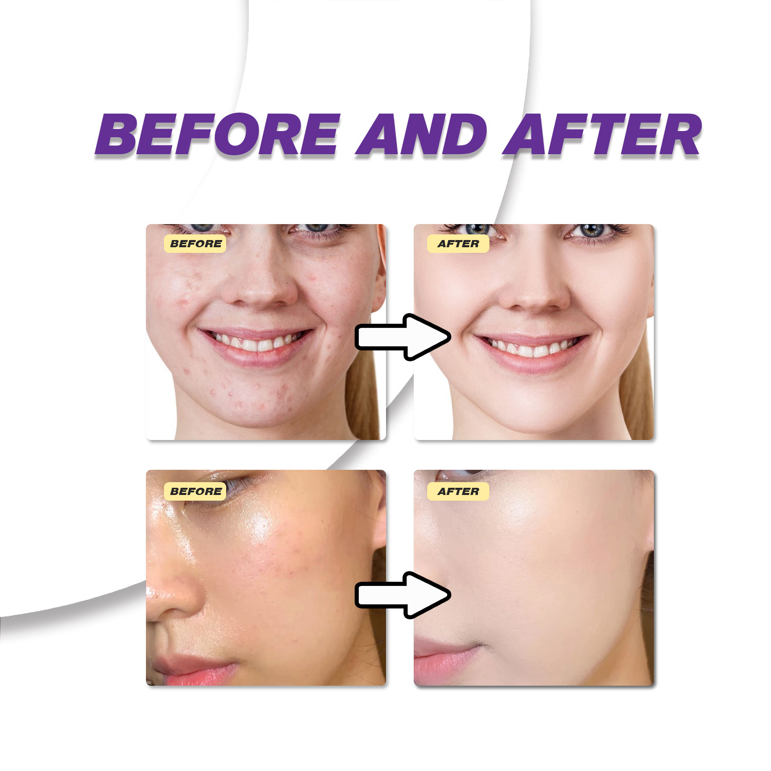 Łagodny krem z kwasem azelaino – Skincare Skintific recenzja i cena