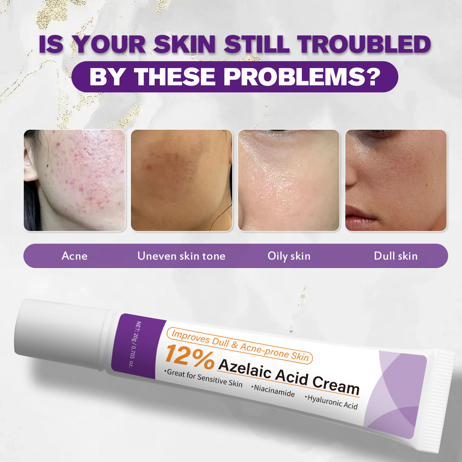 Łagodny krem z kwasem azelaino – Skincare Skintific recenzja i cena