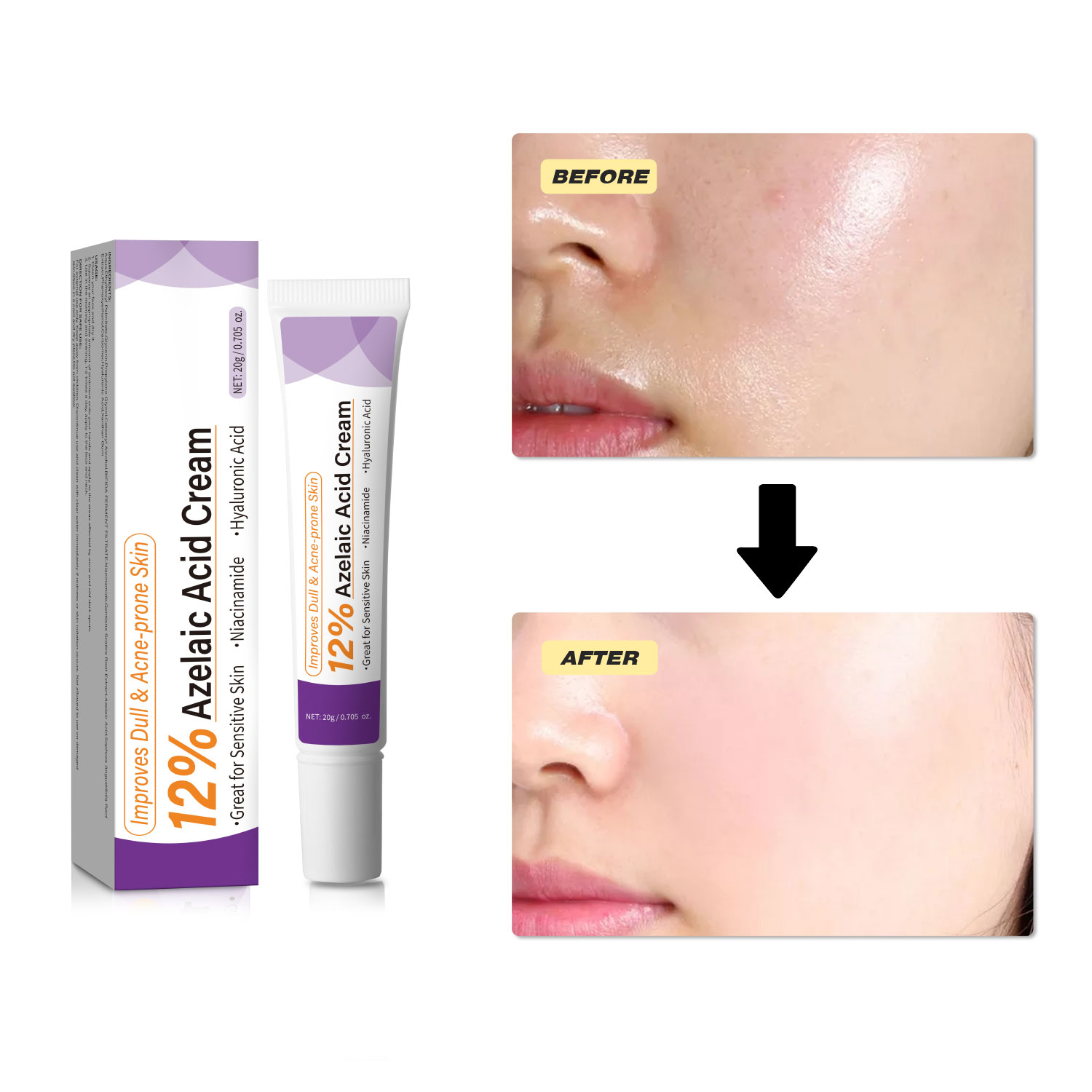 Łagodny krem z kwasem azelaino – Skincare Skintific recenzja i cena